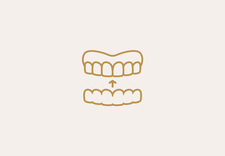 Aligners